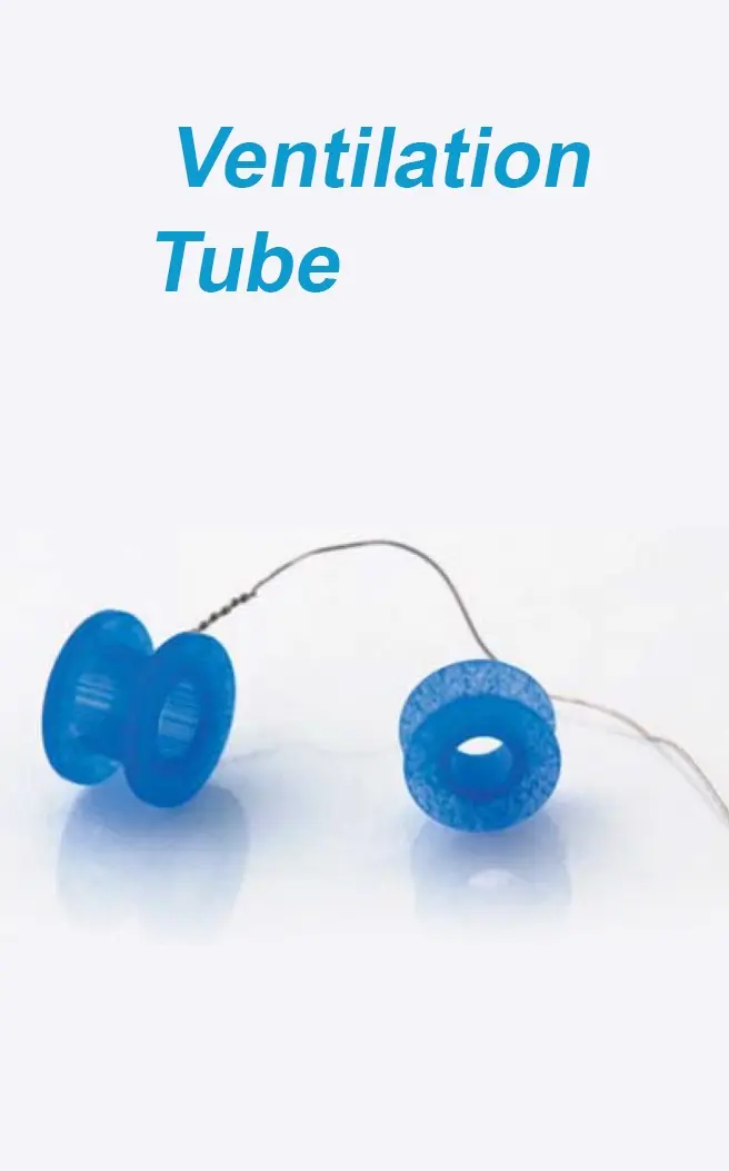 Ventilation Tube