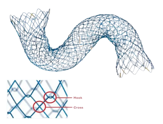 Biliary stent HANAROSTENT® CCC